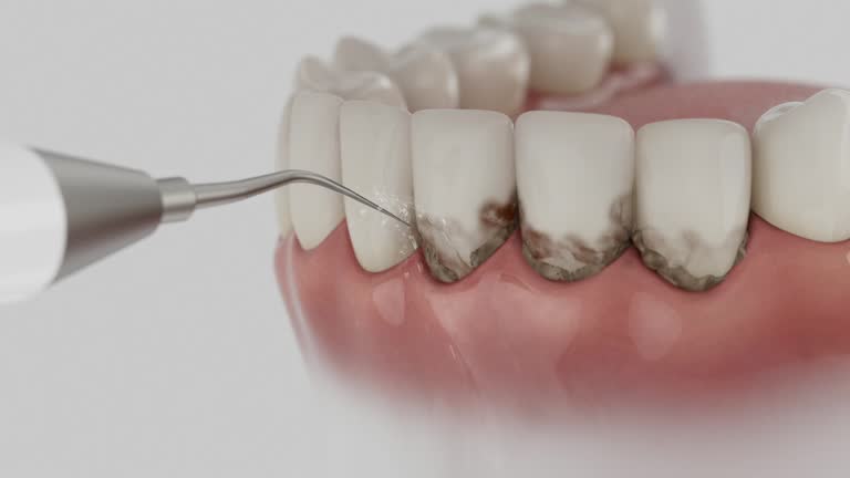 Reliable Emergency Dentist contractor in Lexington, MO by Smile Center Dentistry